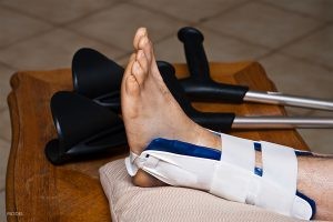 Tips to Recover Faster from a Stress Fracture